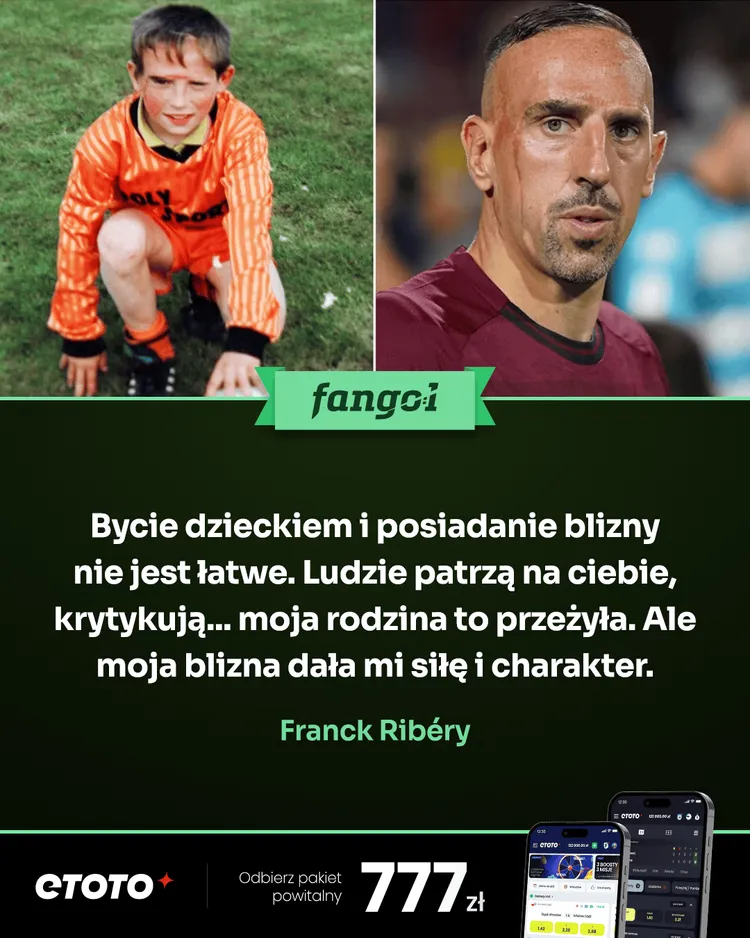 Franck Ribery i historia jego blizny na twarzy!