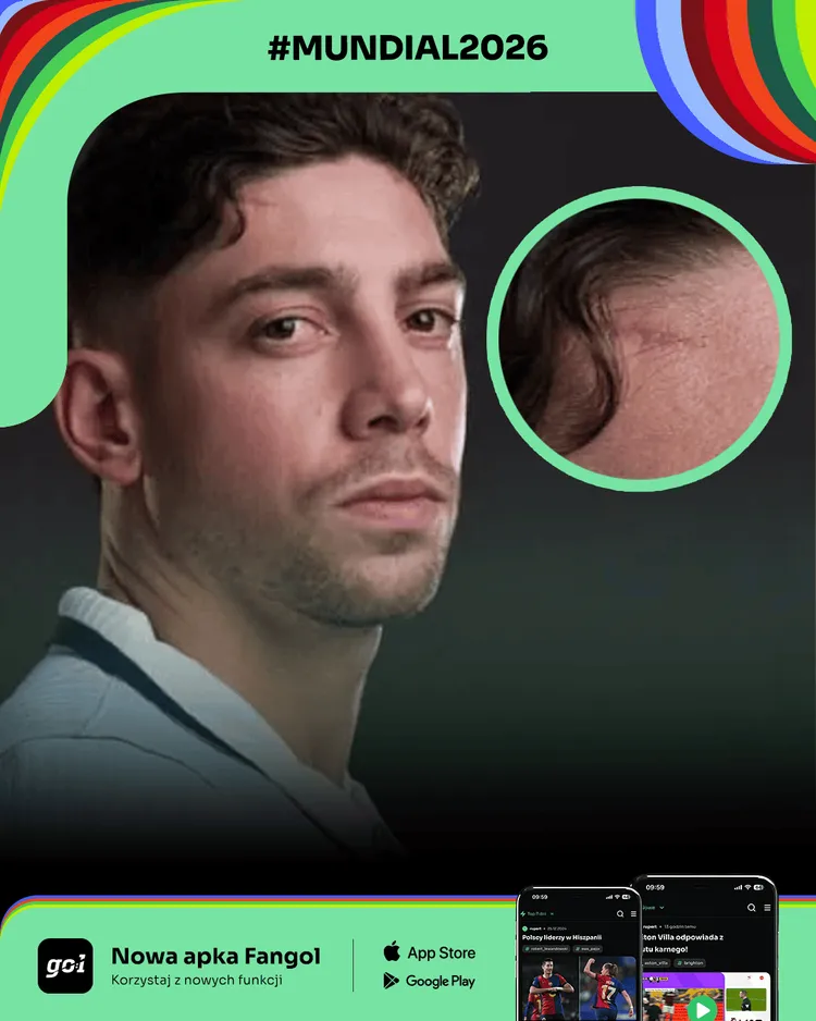 Fede Valverde ma pamiątkę po sprzeczce z klubowym kolegą